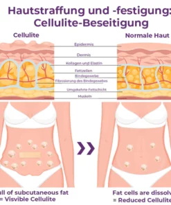 Alternative view of flysmus™ CelluFirmX Haut-Rebound Verstärkung Pflaster