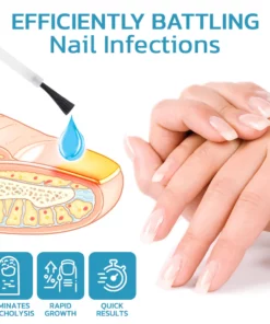 flysmus™ OnycholysisHeal Nail Strengthening And Growth Conditioner