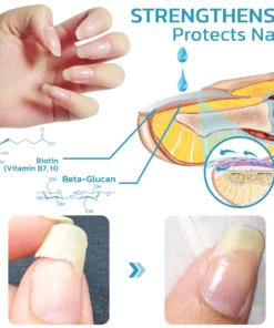 flysmus™ OnycholysisHeal Nail Strengthening And Growth Conditioner