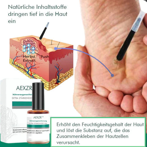 AEXZR™ Hühneraugenentfernung Extra Starkes -geeli