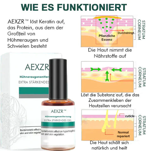 AEXZR™ Hühneraugenentfernung Extra Starkes Gel