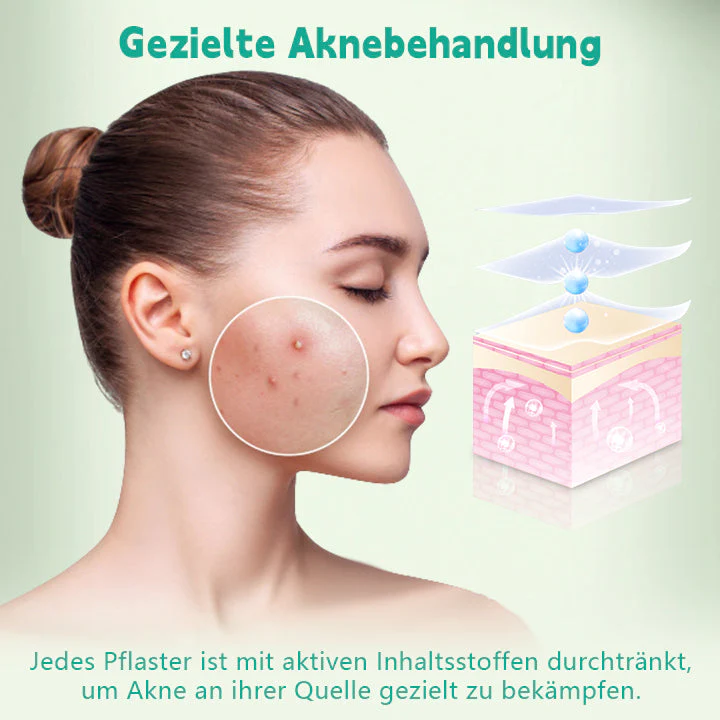 Biancat™ GentleCare Akne-Heilpflaster