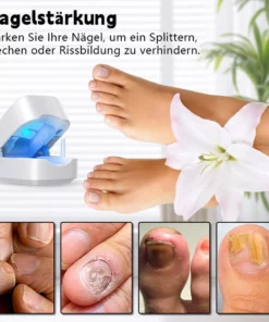 Biancat™ Nagelpilz-Infektionsreparaturgerät
