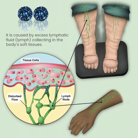 CZTICLE™ Magnetologie Lymphvity Germanium Ohrringe