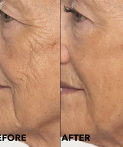 Double Retinol & Collagen Peptide Serum Treatment