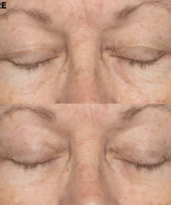 Double Retinol & Collagen Peptide Serum Treatment