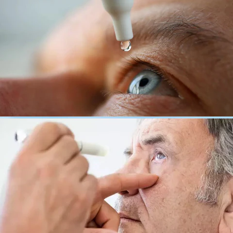 Fivfivgo™ Cataract and Glaucoma Mositurizing Eye Drops