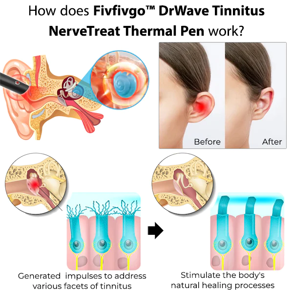 Fivfivgo™ DrWave Tinnitus NerveTreat Thermostift