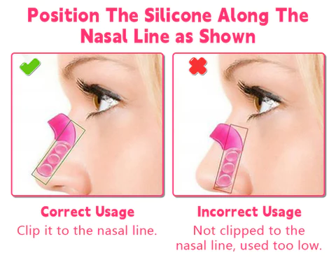 Fivfivgo™ Magic Nose Shaper Device