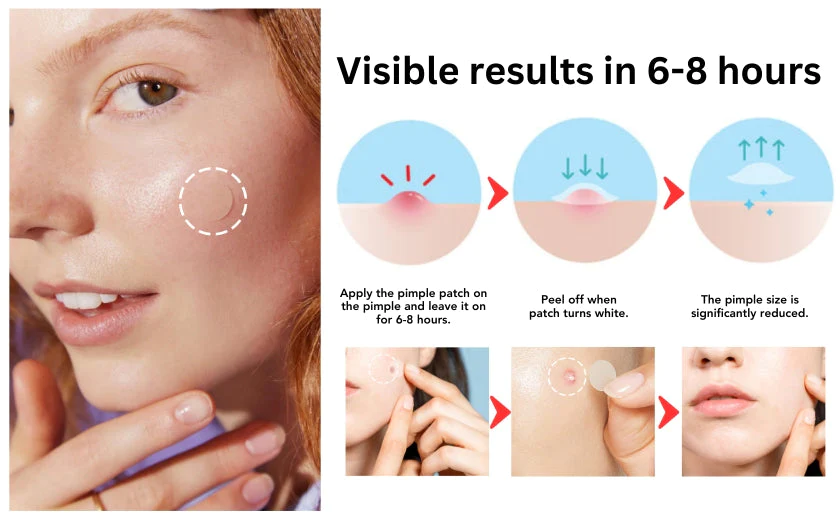 Fivfivgo™ Nighttime Acne Patch