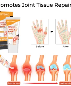 Fivfivgo™ DeerAntler Gelenk- und Knochentherapie-Balsam