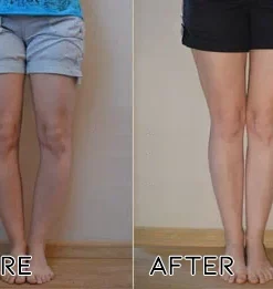 Fivfivgo™ DeerAntler Gelenk- und Knochentherapie-Balsam