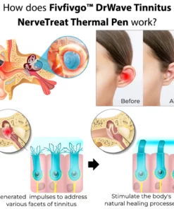 Fivfivgo™ DrWave Tinnitus NerveTreat Thermostift