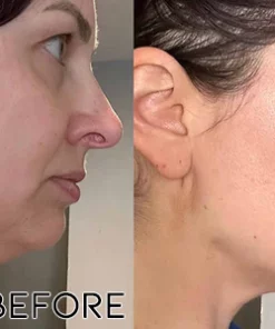 Fivfivgo™ Elektrisches Gua Sha-Ultraschall-Schönheitsgerät