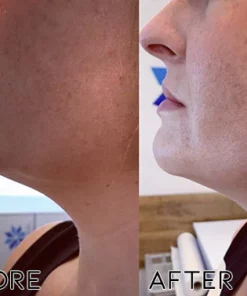 Fivfivgo™ Elektrisches Gua Sha-Ultraschall-Schönheitsgerät