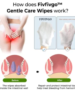 Fivfivgo™ Gentle Care Wipes