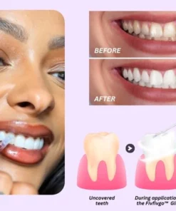 Fivfivgo™ Glänzender Zahn Glanz