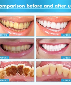 Fivfivgo™ Pflanzlicher aufhellender Reparaturschaum für den Mund
