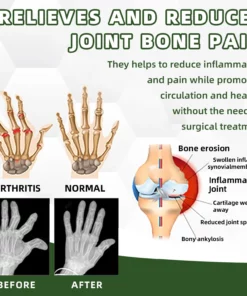 Fivfivgo™ Schmerz- und Knochenheilungscreme mit australischem Honigbienengift