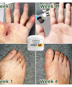 Fivfivgo™ Schmerz- und Knochenheilungscreme mit australischem Honigbienengift