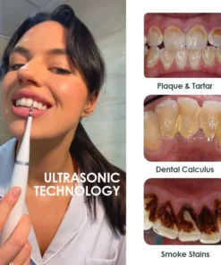 Fivfivgo™ Ultrasonic Tooth Cleaner