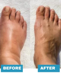 Foot Massager For Lasting Foot Pain Relief