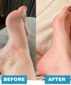 Foot Massager For Lasting Foot Pain Relief