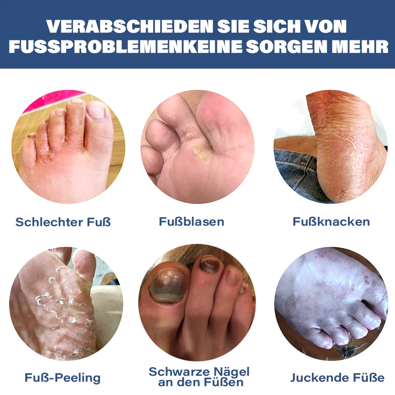 Furzero™ Nagelpilz Fußspray