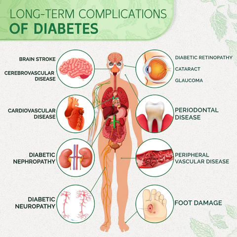 Furzero™ DiabetesCare SugarDown Health Control Spray