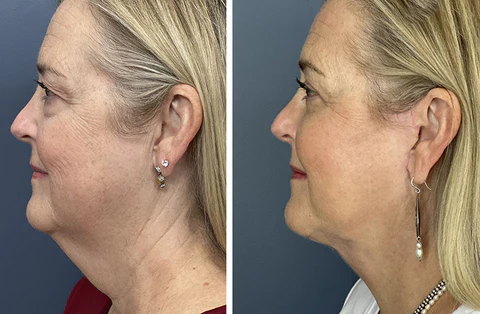 Futusly™ LymphHeal Magnetic Therapy Earrings<br />