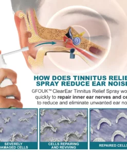 GFOUK™ ClearEar Tinnitus Relief Spray