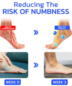 GFOUK™ EaseNerve Hands and Foots Patch