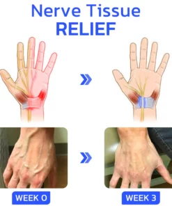 GFOUK™ EaseNerve Hands and Foots Patch