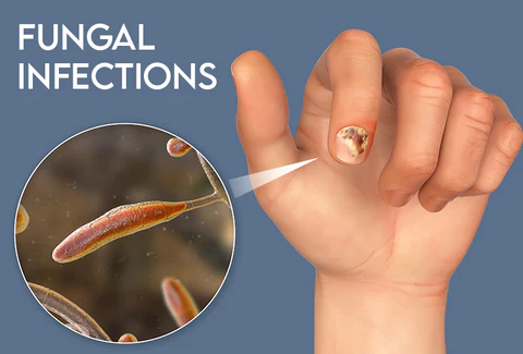 GFOUK™ FungiGuard Nail Treatment Cream