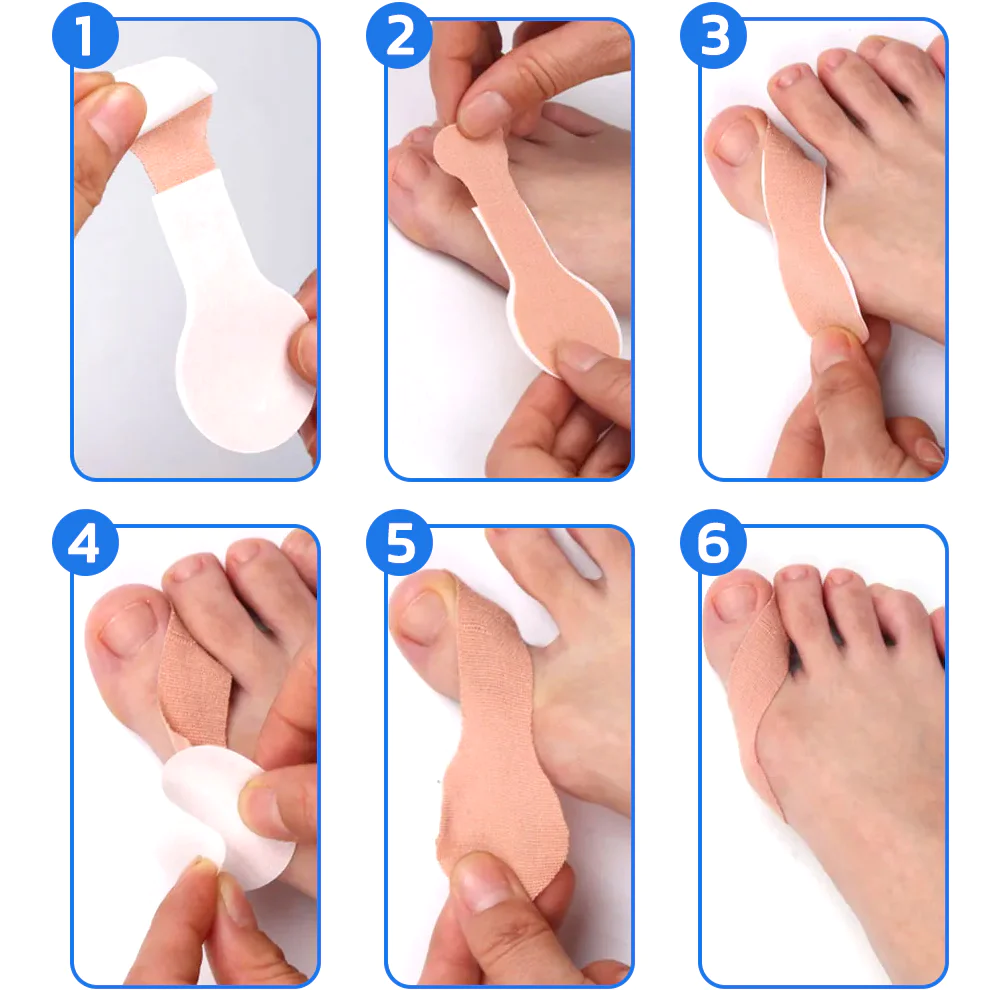 GFOUK™ HealthToe Joint Correcter Pression Patch