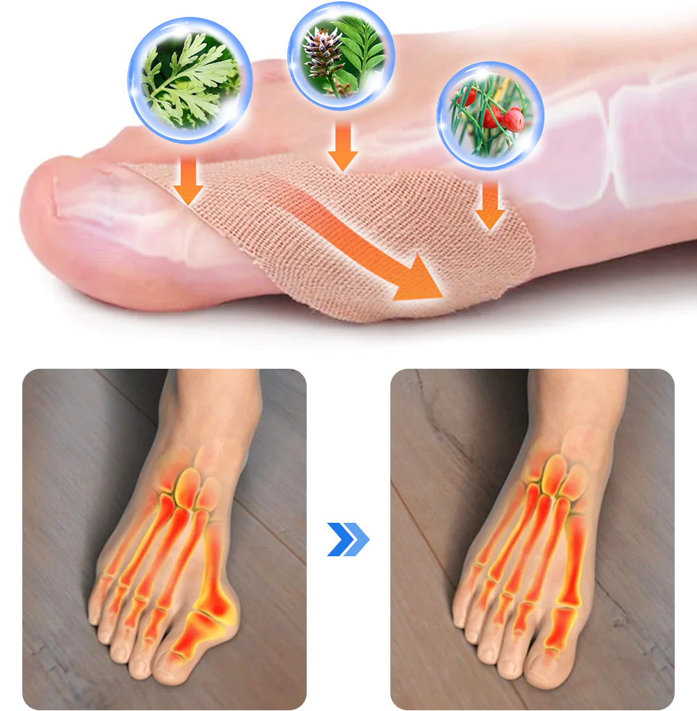 GFOUK™ HealthToe Joint Correcter Pression Patch