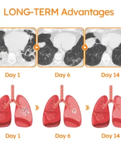 GFOUK™ PollenGuard Microcapsule Aspirator