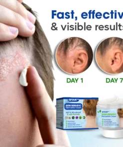 GFOUK™ Seborrheic Dermatitis Cream