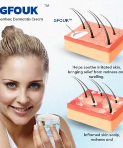 GFOUK™ Seborrheic Dermatitis Cream