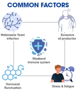 GFOUK™ Seborrheic Dermatitis Cream