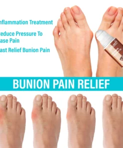 JointCare Anti Bunion Treatment Oil