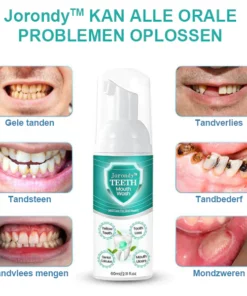 Jorondy™ TEETH Mondwater - Los alle orale problemen op