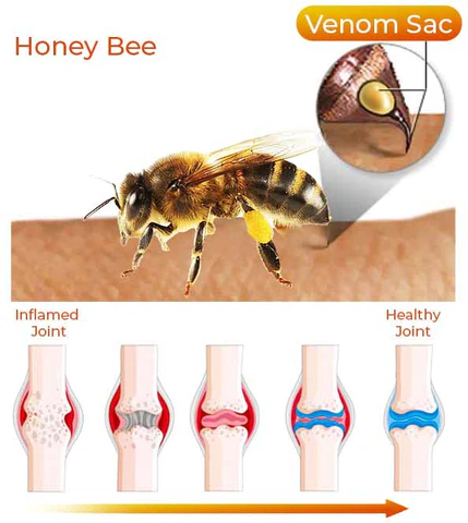 LERCEA™ Bienenstich-Schmerz- und Knochenheilungscreme