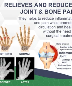 LERCEA™ Bienenstich-Schmerz- und Knochenheilungscreme