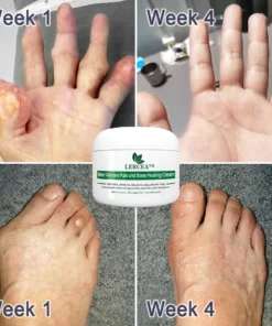 LERCEA™ Bienenstich-Schmerz- und Knochenheilungscreme