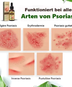 LERCEA™ Psoriasis Heilung Ätherisches Öl