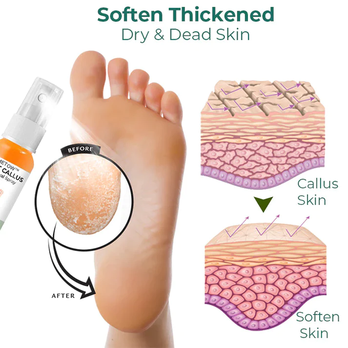 LIMETOW™ Foot Callus Removal Spray