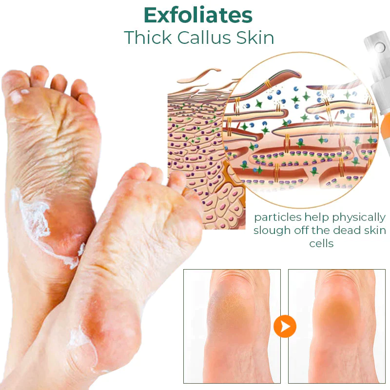 LIMETOW™ Foot Callus Removal Spray