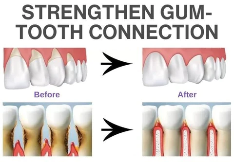 LIMETOW™ Gum Repairing Gel
