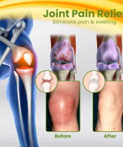 LIMETOW™ BEETox Joint & Bone Therapy Cream